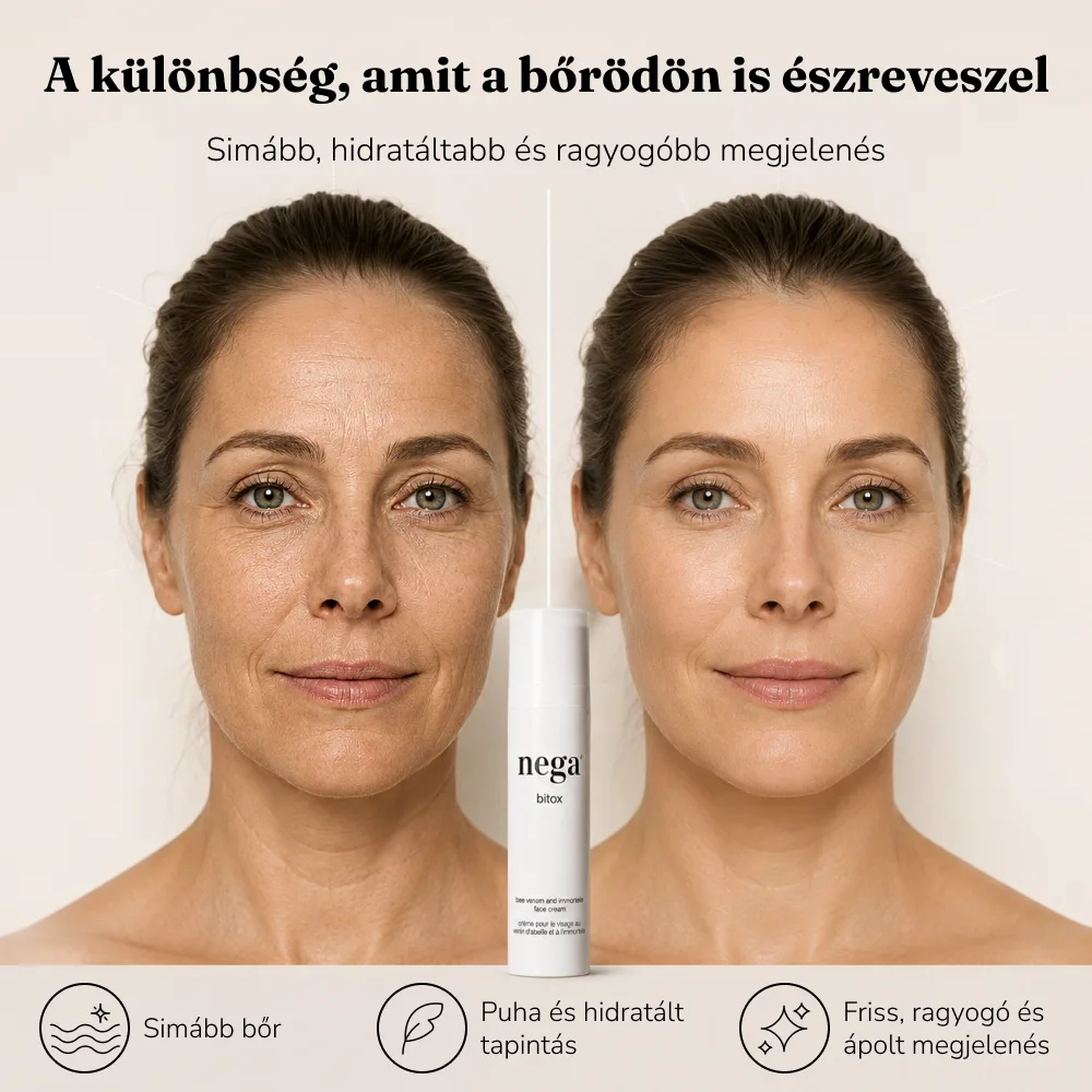 Bitox, méhméreg krém - Image 6